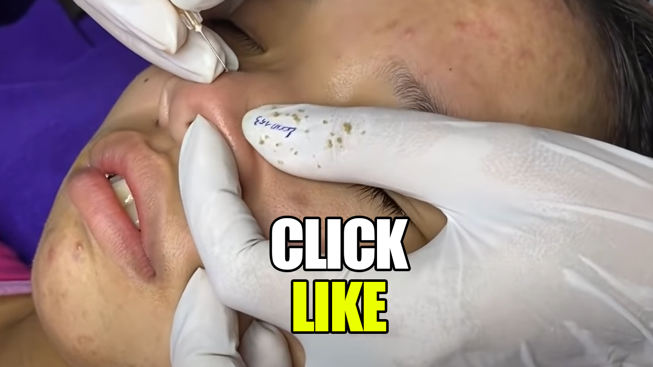 9 Minutes of Popping