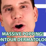 Satisfying Short Pops Compilation | Contour Dermatology